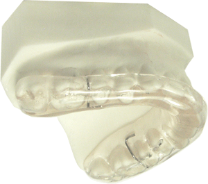 Upper Occlusal Acrylic Splint